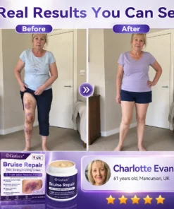 𝗚𝗮𝗳𝗮𝗰𝗲® Bruise Care & Skin Strengthening Cre