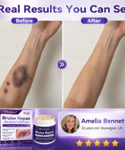 𝗚𝗮𝗳𝗮𝗰𝗲® Bruise Care & Skin Strengthening Cre