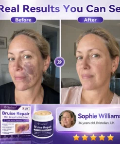 𝗚𝗮𝗳𝗮𝗰𝗲® Bruise Care & Skin Strengthening Cre