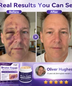 𝗚𝗮𝗳𝗮𝗰𝗲® Bruise Care & Skin Strengthening Cre